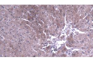 Detection of TEC in Human Liver Tissue using Polyclonal Antibody to Tec Protein Tyrosine Kinase (TEC) (Tec Protein Tyrosine Kinase (TEC) (AA 370-623) antibody)