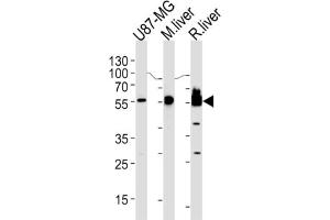 Western Blotting (WB) image for anti-3-Hydroxy-3-Methylglutaryl-CoA Synthase 1 (Soluble) (HMGCS1) antibody (ABIN3002732) (HMGCS1 antibody)