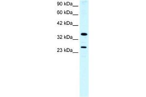 Human Lung; WB Suggested Anti-ASGR2 Antibody Titration: 0. (Asialoglycoprotein Receptor 2 antibody  (N-Term))