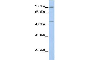 WB Suggested Anti-GTF2H4 Antibody Titration:  0.