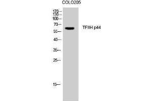 Western Blotting (WB) image for anti-General Transcription Factor IIH, Polypeptide 2, 44kDa (GTF2H2) (N-Term) antibody (ABIN3187237) (GTF2H2 antibody  (N-Term))