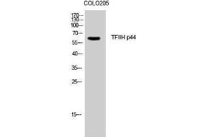 Western Blotting (WB) image for anti-General Transcription Factor IIH, Polypeptide 2, 44kDa (GTF2H2) (N-Term) antibody (ABIN3187237)