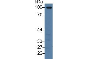 Western Blot; Sample: Human Lung lysate; Primary Ab: 3µg/ml Rabbit Anti-Human TM Antibody Second Ab: 0. (Thrombomodulin antibody  (AA 31-169))