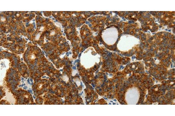 SELM antibody