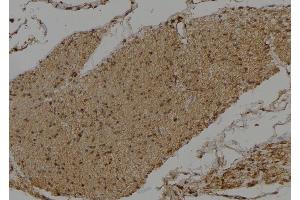 ABIN6275519 at 1/100 staining Human gastric tissue by IHC-P. (DVL3 antibody)