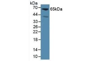 Detection of GPC3 in Mouse Liver Tissue using Polyclonal Antibody to Glypican 3 (GPC3) (Glypican 3 antibody  (AA 344-559))