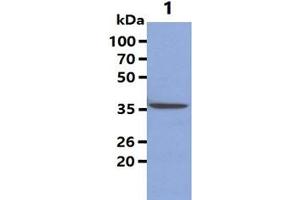 The Cell lysates (40ug) were resolved by SDS-PAGE, transferred to PVDF membrane and probed with anti-human Maspin antibody (1:1000).