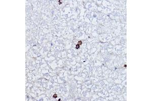 Immunohistochemistry of paraffin-embedded mouse liver using Phospho-Histone H3-S10 Rabbit pAb (ABIN7267687) at dilution of 1:2000 (40x lens).