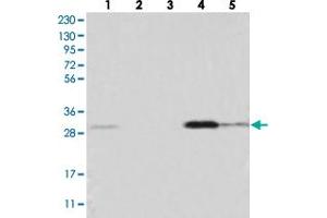Western blot analysis of Lane 1: RT-4, Lane 2: U-251 MG, Lane 3: Human Plasma, Lane 4: Liver, Lane 5: Tonsil with WDR33 polyclonal antibody .