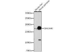 Western blot analysis of extracts of various cell lines, using CEACAM5 antibody.