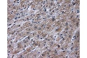 Immunohistochemical staining of paraffin-embedded liver tissue using anti-KIAA1609 mouse monoclonal antibody. (KIAA1609 antibody)