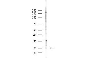 anti-Cytochrome C Oxidase Subunit VIIa Polypeptide 2 (Liver) (COX7A2) (N-Term) antibody