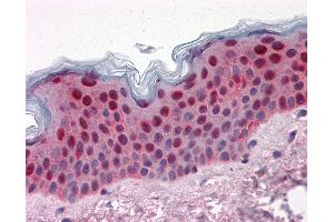 Anti-SFN / 14-3-3 Sigma antibody IHC of human skin. (14-3-3 sigma/SFN antibody  (AA 1-249))