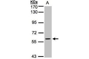 Western Blot using AP22398PU-N MAPK4 antibody at 1/1000 dilution: Sample (30 µg whole cell lysate) A: H1299 7. (MAPK4 antibody  (N-Term))