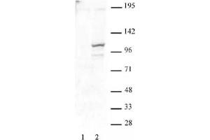 STAT2 phospho Tyr689 pAb tested by Western blot. (STAT2 antibody  (pTyr689))