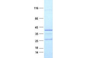 Validation with Western Blot