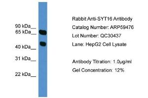 WB Suggested Anti-SYT16  Antibody Titration: 0. (SYT16 antibody  (N-Term))