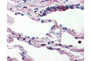 Immunohistochemistry (IHC) image for anti-Complement Component 5a Receptor 1 (C5AR1) antibody (ABIN2470782) (C5AR1 antibody)