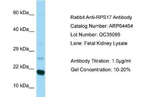 Western Blotting (WB) image for anti-Ribosomal Protein S17 (RPS17) (C-Term) antibody (ABIN2789846) (RPS17 antibody  (C-Term))