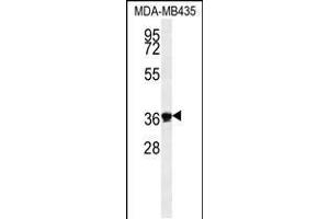 Western blot analysis in MDA-MB435 cell line lysates (35ug/lane). (EXO5 antibody  (AA 166-193))