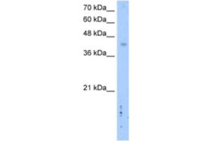 Western Blotting (WB) image for anti-Leucine Rich Repeat Containing 2 (LRRC2) antibody (ABIN2462610) (LRRC2 antibody)