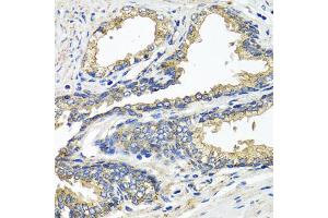 Immunohistochemistry of paraffin-embedded human prostate using ETFA antibody (ABIN5975750) at dilution of 1/100 (40x lens).