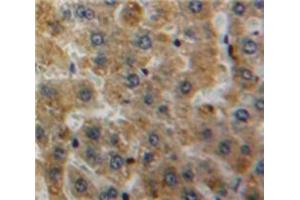 Used in DAB staining on fromalin fixed paraffin-embedded Liver tissue (APOH antibody  (AA 22-345))