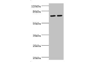 Western blot All lanes: Arachidonate 15-lipoxygenase B antibody at 11 μg/mL Lane 1: MCF-7 whole cell lysate Lane 2: 293T whole cell lysate Secondary Goat polyclonal to rabbit IgG at 1/10000 dilution Predicted band size: 76, 68, 70, 73 kDa Observed band size: 76 kDa