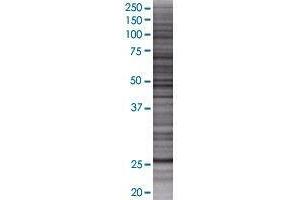 CCDC28B transfected lysate. (CCDC28B 293T Cell Transient Overexpression Lysate(Denatured))