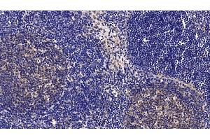 Immunohistochemistry (IHC) image for anti-CD40 Ligand (CD40LG) (AA 111-261) antibody (ABIN7438637)