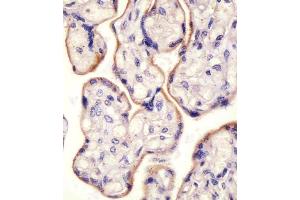 Immunohistochemistry (Paraffin-embedded Sections) (IHC (p)) image for anti-Transferrin Receptor (p90, CD71) (TFRC) (AA 649-677), (C-Term) antibody (ABIN650772)