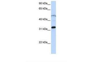 Image no. 1 for anti-Eukaryotic Translation Initiation Factor 3, Subunit G (EIF3G) (AA 218-267) antibody (ABIN6737929) (EIF3G antibody  (AA 218-267))