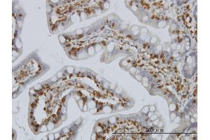 Immunoperoxidase of monoclonal antibody to PIP5K2A on formalin-fixed paraffin-embedded human small Intestine. (PIP4K2A antibody  (AA 304-365))