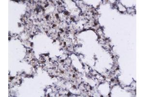 Formalin-fixed and paraffin embedded mouse lung tissue labeled with Anti- IL-5 Polyclonal Antibody, Unconjugated (ABIN674904) followed by conjugation to the secondary antibody and DAB staining (IL-5 antibody  (AA 56-132))