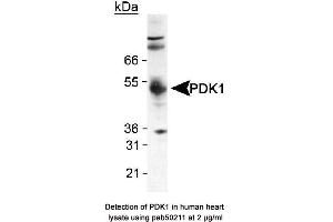 Image no. 1 for anti-Pyruvate Dehydrogenase Kinase (AA 350-436), (C-Term) antibody (ABIN363520) (Pyruvate Dehydrogenase Kinase (AA 350-436), (C-Term) antibody)