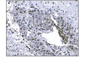 IHC analysis of KMT1B/SUV39H2 using anti-KMT1B/SUV39H2 antibody (ABIN7602135). (SUV39H2 antibody  (AA 6-410))