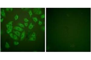 Immunofluorescence analysis of A549 cells, using Stefin A Antibody.
