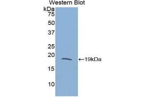 Detection of Recombinant RNASE3, Rat using Polyclonal Antibody to Ribonuclease A3 (RNASE3) (RNASE3 antibody  (AA 33-155))