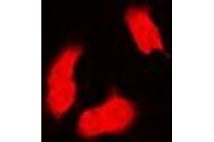 Immunofluorescent analysis of PSMB9 staining in MCF7 cells. (PSMB9 antibody)