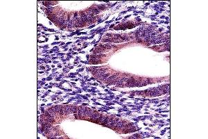 P17 Antibody (C-term) (ABIN657916 and ABIN2846863) iunohistochemistry analysis in formalin fixed and paraffin embedded human uterus tissue followed by peroxidase conjugation of the secondary antibody and DAB staining. (MMP17 antibody  (C-Term))