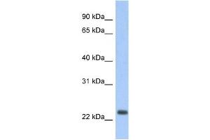 ND6 antibody used at 1 ug/ml to detect target protein. (MT-ND6 antibody)