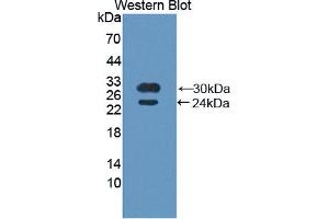 Western blot analysis of recombinant Human BMX. (BMX antibody  (AA 287-523))