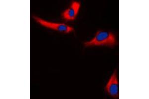 Immunofluorescent analysis of EPS8L3 staining in U251MG cells. (EPS8-Like 3 antibody  (Center))