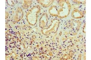 Immunohistochemistry of paraffin-embedded human kidney tissue using ABIN7150218 at dilution of 1:100