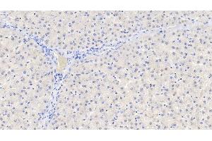 Detection of GDNF in Human Liver Tissue using Polyclonal Antibody to Glial Cell Line Derived Neurotrophic Factor (GDNF) (GDNF antibody  (AA 78-211))