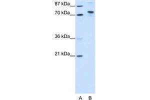 Western Blotting (WB) image for anti-TOX High Mobility Group Box Family Member 4 (TOX4) antibody (ABIN2461858) (TOX4 antibody)