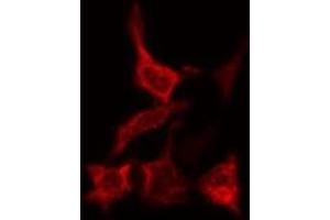 Immunofluorescence (fixed cells) (IF/ICC) image for anti-Catalase (CAT) antibody (ABIN6260491)