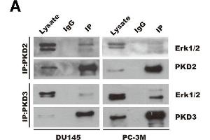 PKD2 and PKD3 promote SCF, CCL5 and CCL11 expression through Erk1/2 signaling pathways. (ERK1 antibody)