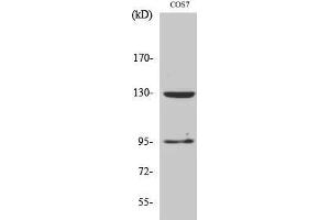 Western Blotting (WB) image for anti-gamma-aminobutyric Acid (GABA) B Receptor, 1 (GABBR1) (C-Term) antibody (ABIN3184723) (GABBR1 antibody  (C-Term))