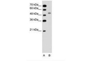 Image no. 2 for anti-Solute Carrier Family 12 (Sodium/potassium/chloride Transporters), Member 1 (SLC12A1) (AA 351-400) antibody (ABIN6736611) (SLC12A1 antibody  (AA 351-400))